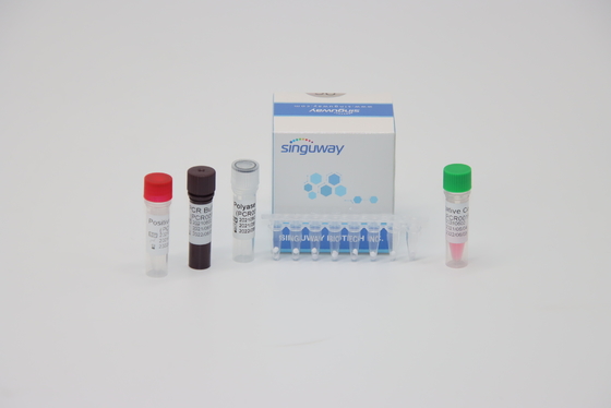 HPV 16 18 Virus Nino Acid Testing RT PCR Test Kit ISO13485