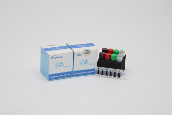 مجموعة PCR عالية الدقة لفيروس نقص المناعة البشرية في الوقت الحقيقي ، POCT IVD ، مجموعات تشخيص PCR السريرية في الوقت الحقيقي